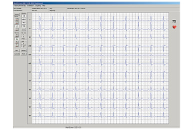 Innobase - Software şi interfaţă PC pentru electrocardiografe, testare la efort, monitoare ATI