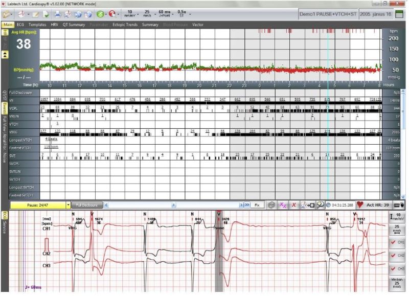 Sistem Holter ECG şi TA: EC-3H/ABP