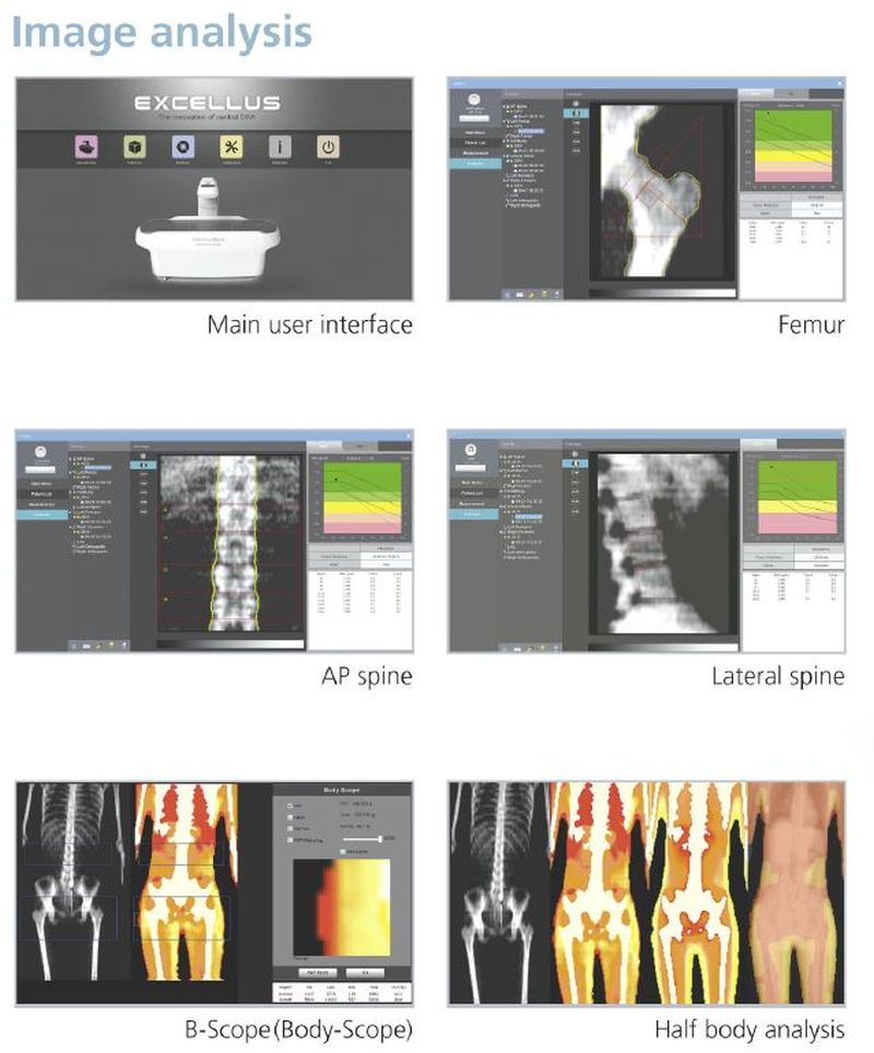 Osteodensitometru inteligent - DXA Excellus cu analizor de compoziţie Half Body