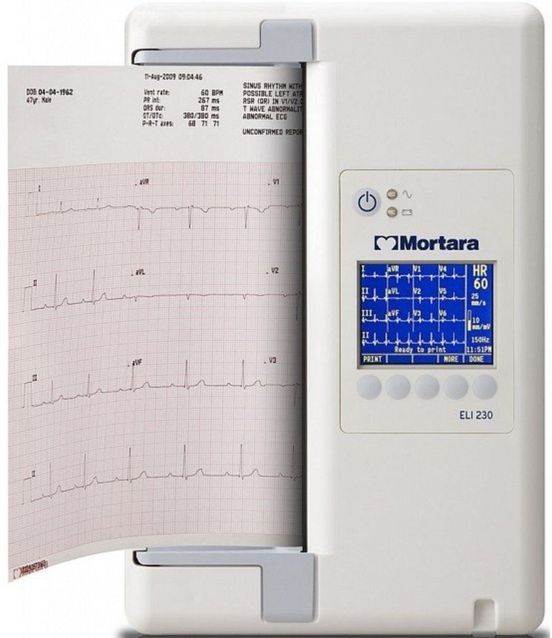 Electrocardiograf portabil Eli230 - Go wirelles!